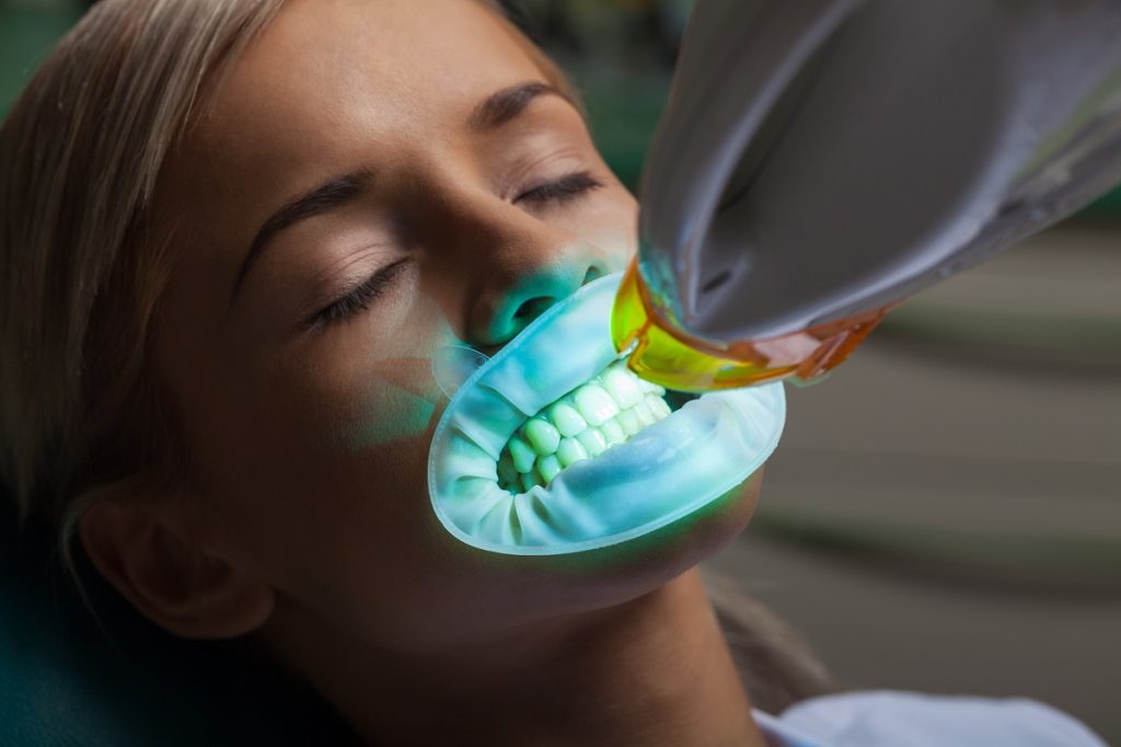 Female patient getting her teeth whitened